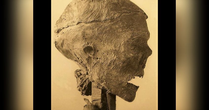 Posthumous Indignities of the Famous 